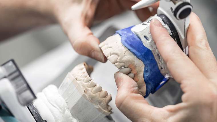 Tooth Replacement | Lambton Dental