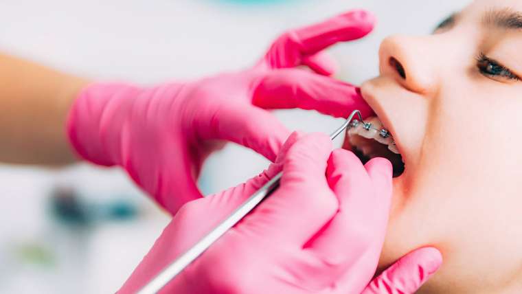 Orthodontics Treatment